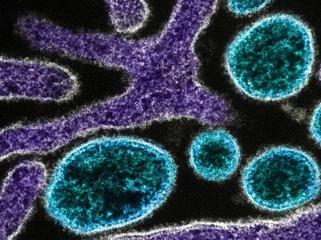 Índia confirma novo surto de vírus Nipah e intensifica vigilância sanitária; países asiáticos reforçam controles